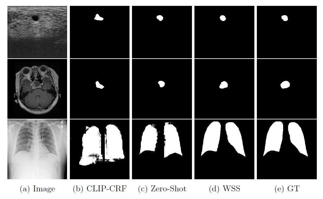 MedCLIP-SAM qualitative results