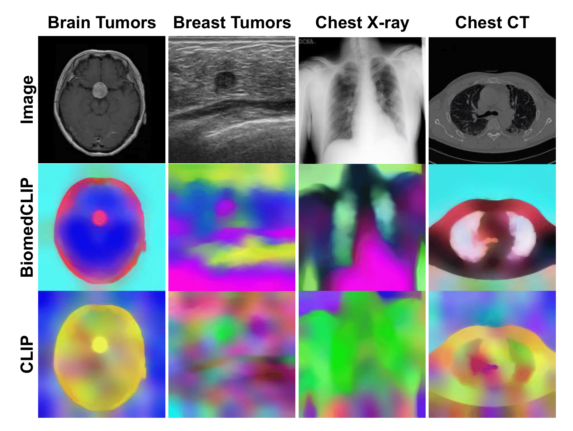 Comparison of BiomedCLIP and CLIP saliency maps across modalities