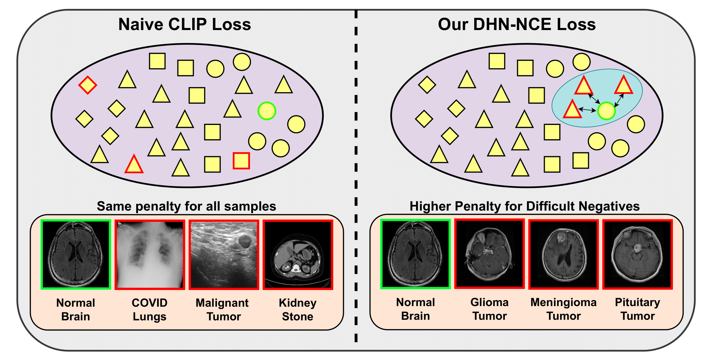 DHN-NCE loss illustration