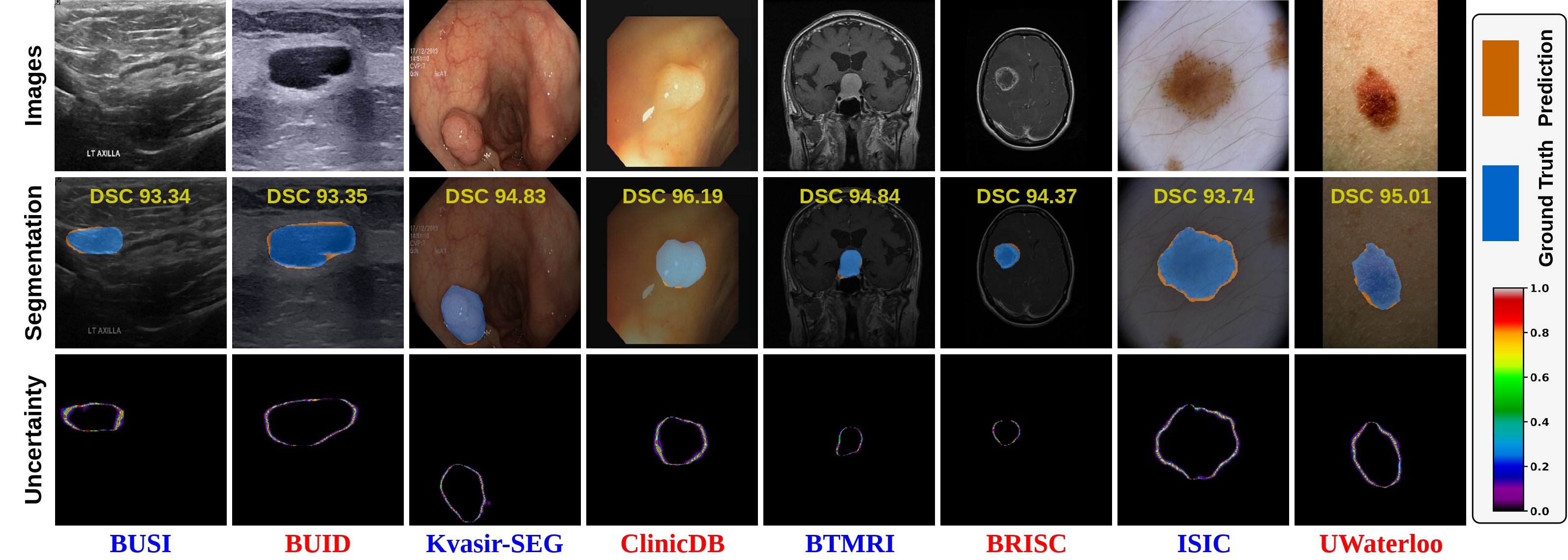 Segmentation and uncertainty visualization