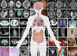 Illustration of medical segmentation